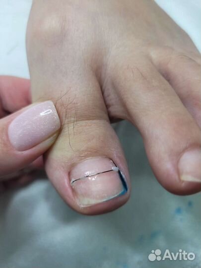 Услуги подолога