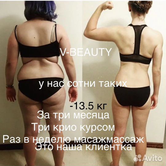 Криолиполиз New система липосакции