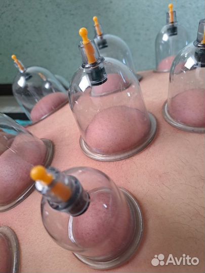 Баночный массаж на спину