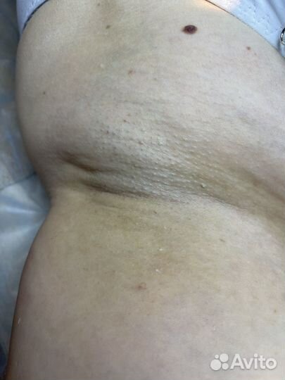 Шугаринг мужской и женский