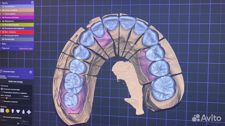 Зуботехническая лаборатория cad-cam центр