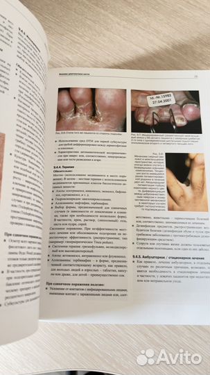 Подология шольц