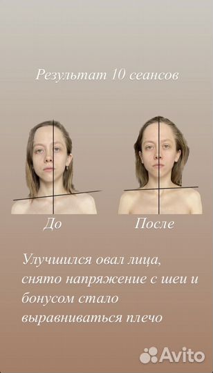 Массаж лица, фейс-пластика, тейпы