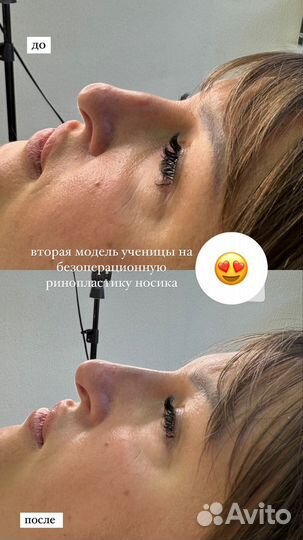 Обучение косметологии