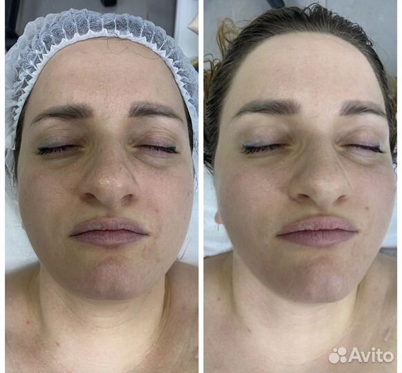 Массаж лица/микротоки/чистка лица