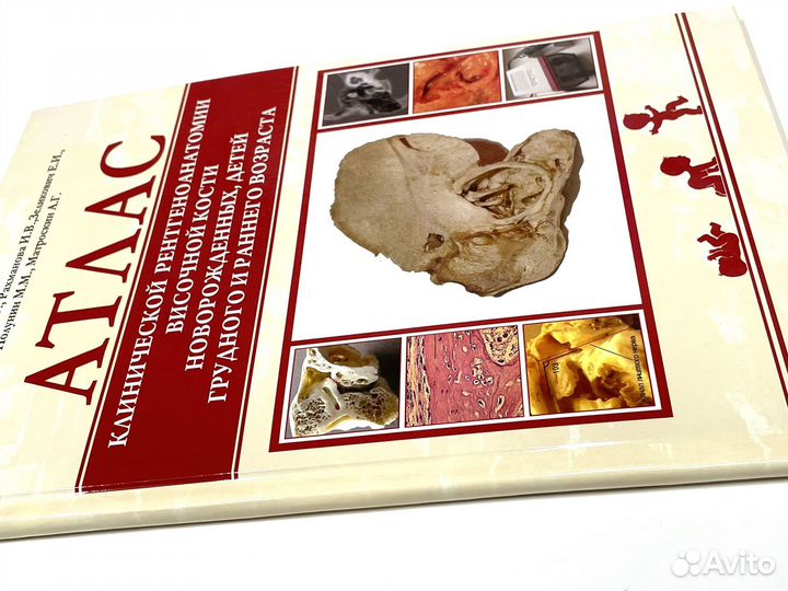 Атлас клинической рентгеноанатомии височной кости