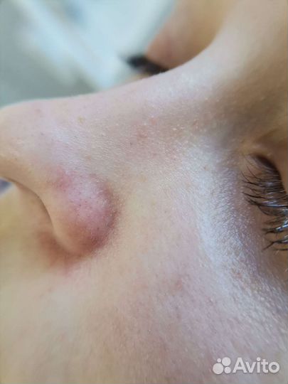 Уз чистка лица + маска