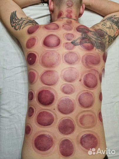 Массаж. Вправление. Избавление от боли