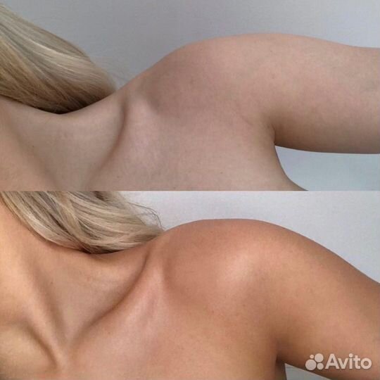 Моментальный загар уфа дема яркий