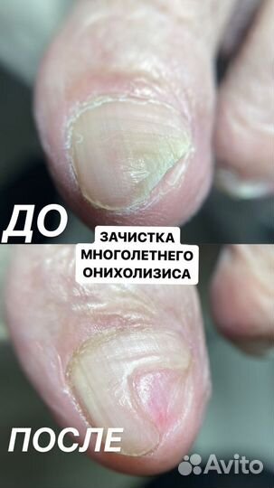 Подолог.Услуги подолога