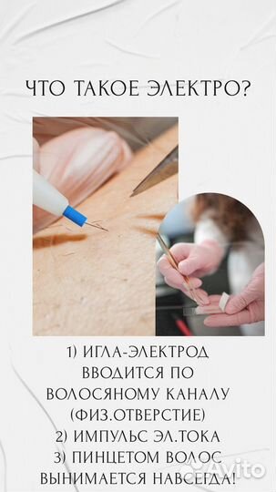 Электроэпиляция модель