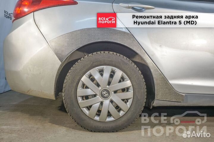 Рем арки для Hyundai Elantra V (MD)