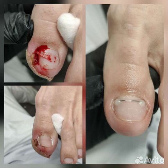 Подолог, Медицинский педикюр, Услуги подолога