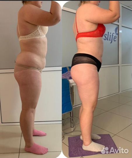 Прощай живот. Комплекс коррекции фигуры