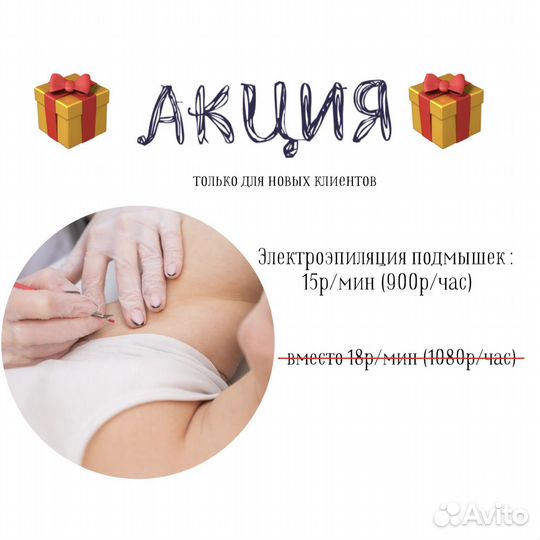 Электроэпиляция