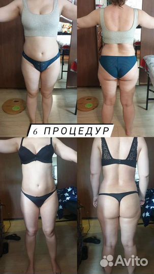 Массаж, коррекция фигуры,EMS