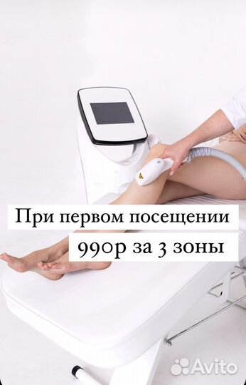 Лазерная эпиляция