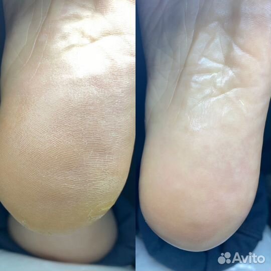 Маникюр, SMART педикюр