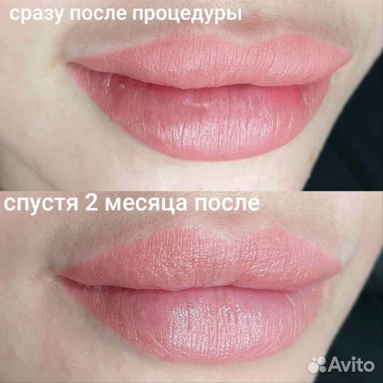 Перманентный макияж ареол