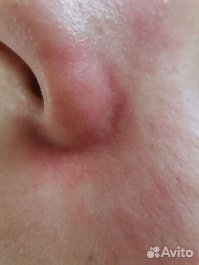 Уз чистка лица + маска