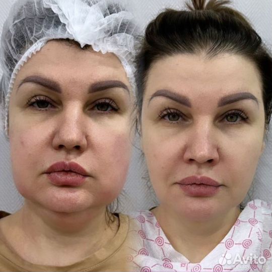 Уменьшение объема талии. До -10 см, Красноярск