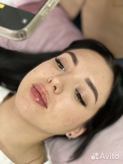 Косметолог контурная пластика ботокс