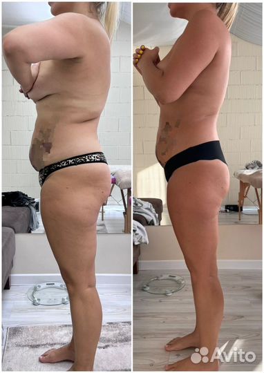 Массаж сфера