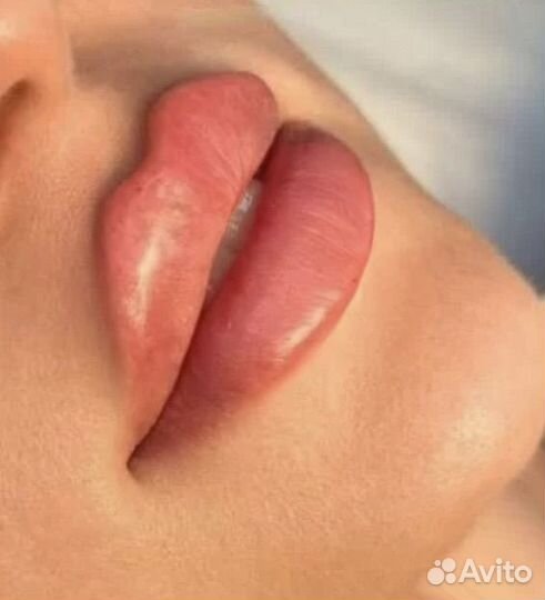 Косметолог с опытом, увеличение губ, профиль Джоли