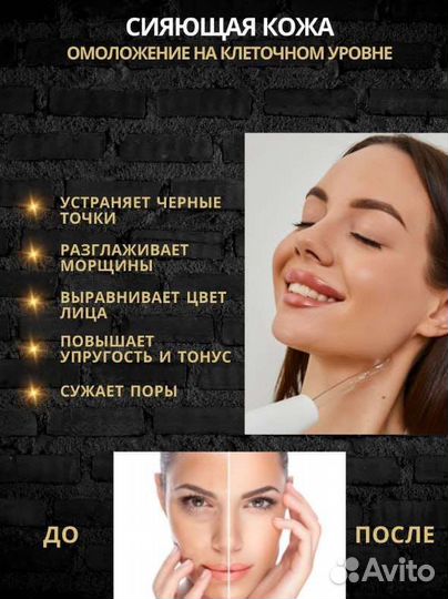 Дарсонваль новый