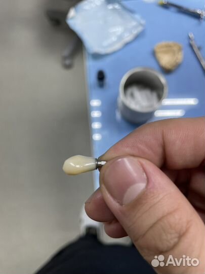 Коронка на имплант