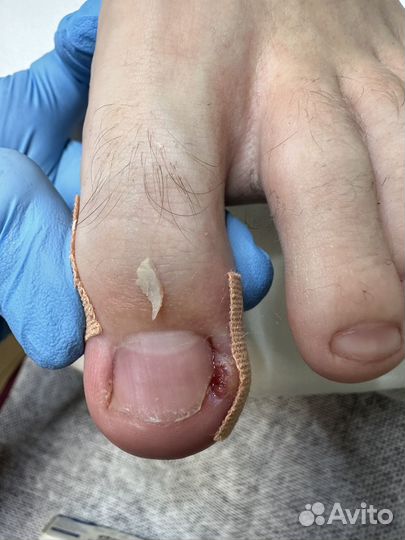 Мастер педикюра подолог