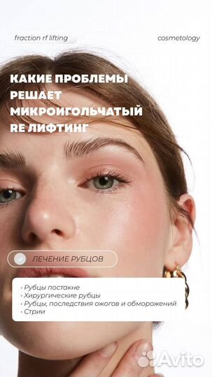 Микроигольчатый RF лифтинг
