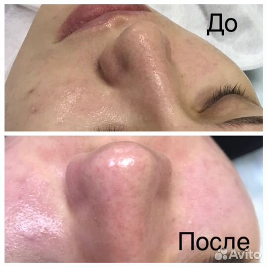 Услуги косметолога