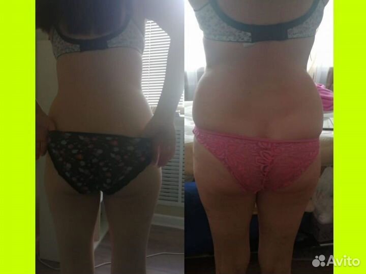 Массаж лица и тела Коррекция фигуры