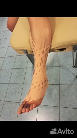 Коррекция фигуры,эстетическое кинезио тейпирование