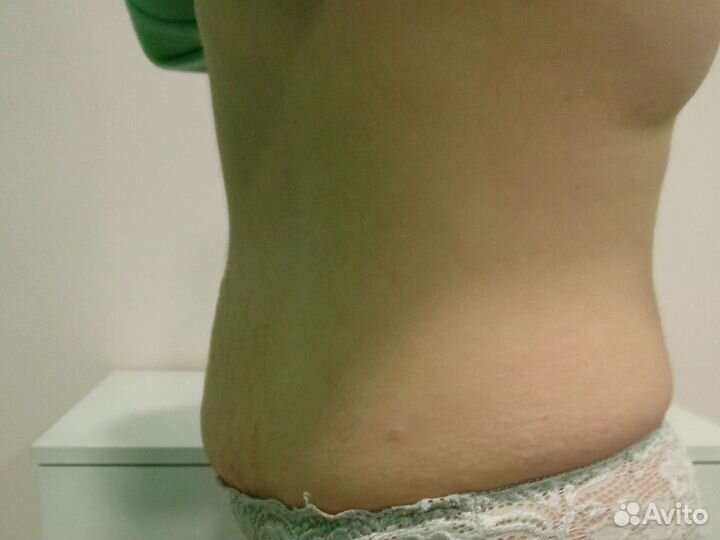 Модели на ботокс, липолитики