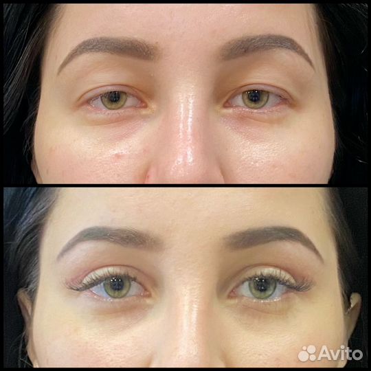 Консультация пластического хирурга