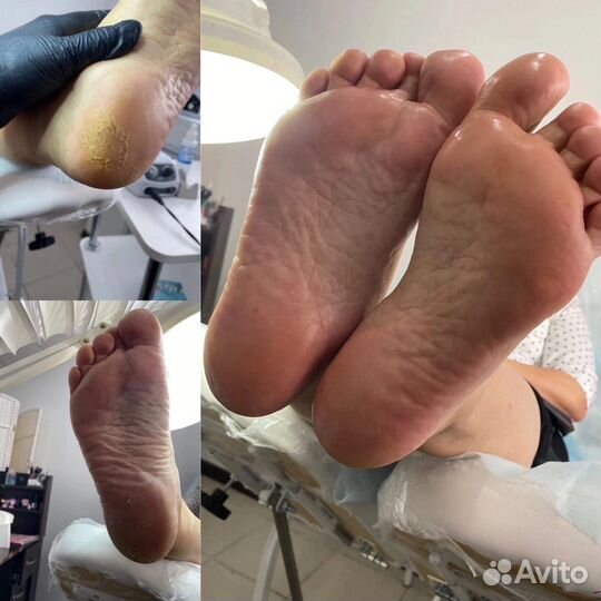 Аппаратный маникюр