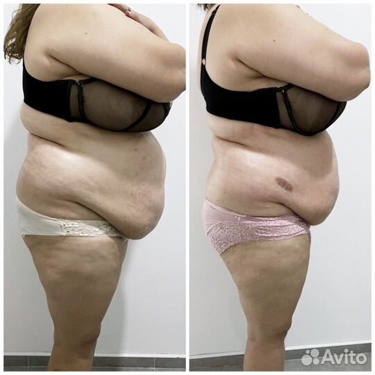 Вакуумный массажер для тела vellashape v8c1