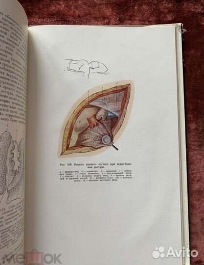 Гнойные заболевания легких и плевры 1967 г