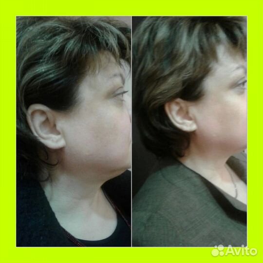 Массаж лица и тела Коррекция фигуры