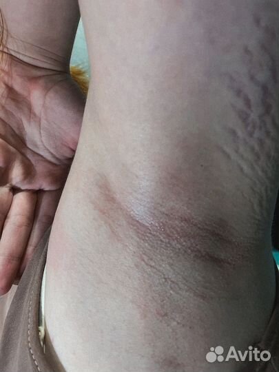 Депиляция шугаринг