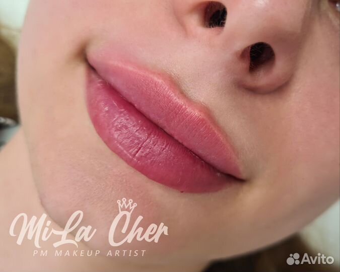 Увеличение губ