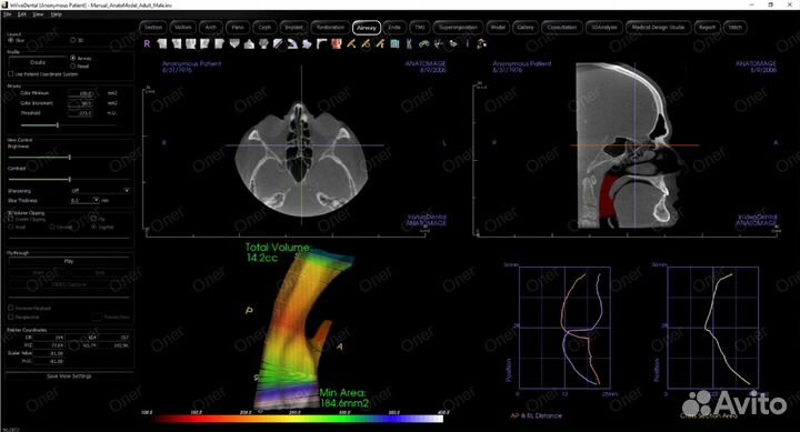 Invivo 7.1.3 2024 года