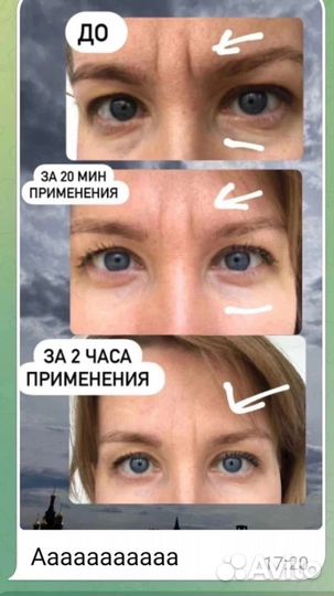 Гидролевые патчи от Сибирского здоровья