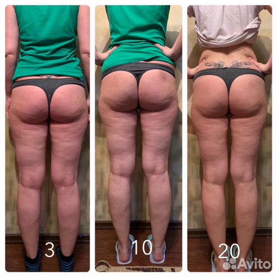 Массаж (Классика, Антицелюлитный)