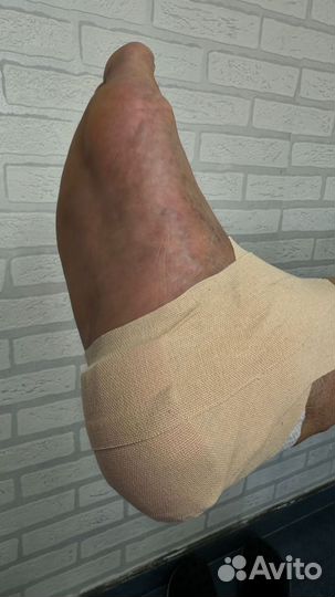 Услуги подолога