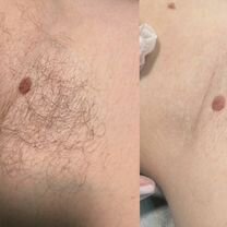 Профессиональный спа-шугаринг и восковая эпиляция, Егорьевск