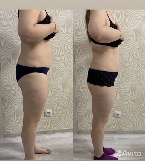 Аппаратный лимфодренажный массаж