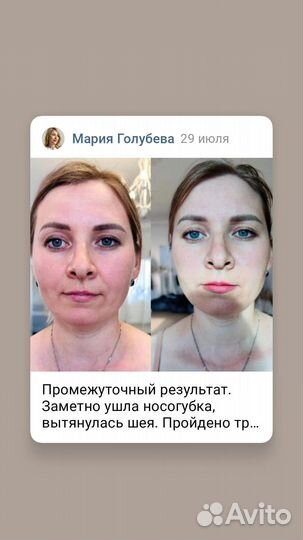 Массаж лица